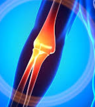 Επικονδυλίτιδα